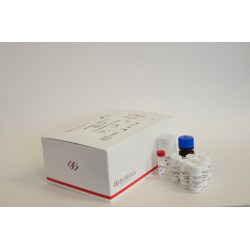 IMUBIND® vWF ELISA, 96 microwell plate 